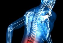 Un paciente parapléjico puede volver a caminar gracias a un electrodo implantado en su columna vertebral