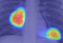 Startup chilena crea plataforma que analiza radiografías en cinco segundos para detectar Covid-19