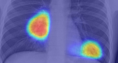 Startup chilena crea plataforma que analiza radiografías en cinco segundos para detectar Covid-19